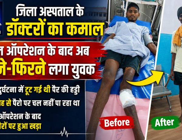 जिला अस्पताल के डॉक्टरों का कमाल, जटिल ऑपरेशन के बाद अब चलने-फिरने लगा युवक